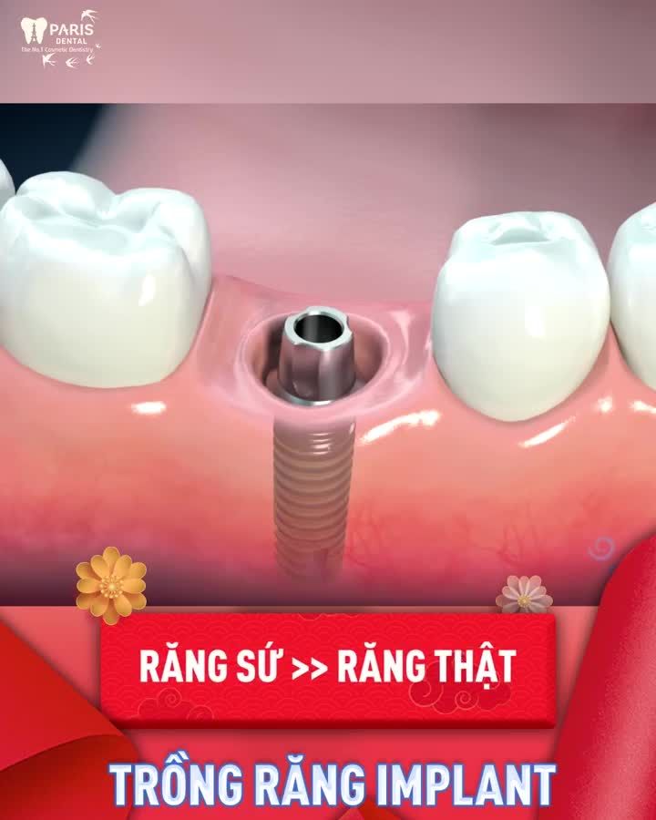Muốn có Cơm Ăn thì phải Trồng Lúa Nhưng muốn ăn ngon thì phải trồng răng