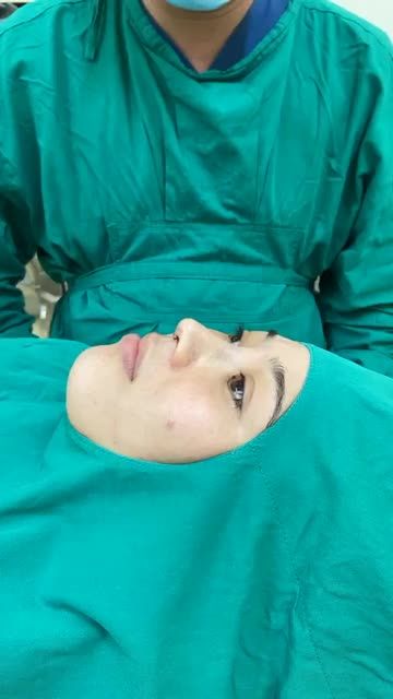 Case NÂNG MŨI CẤU TRÚC SỤN SURGIFORM