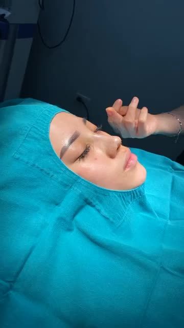 HOÀN THIỆN NHAN SẮC SAU 45P NÂNG MŨI CẤU TRÚC SOFTXIL