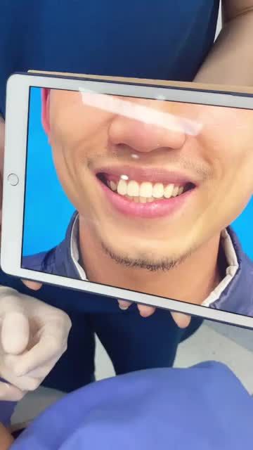 Niềng răng Kangnam Vừa TỐC ĐỘ vừa THẨM MỸ