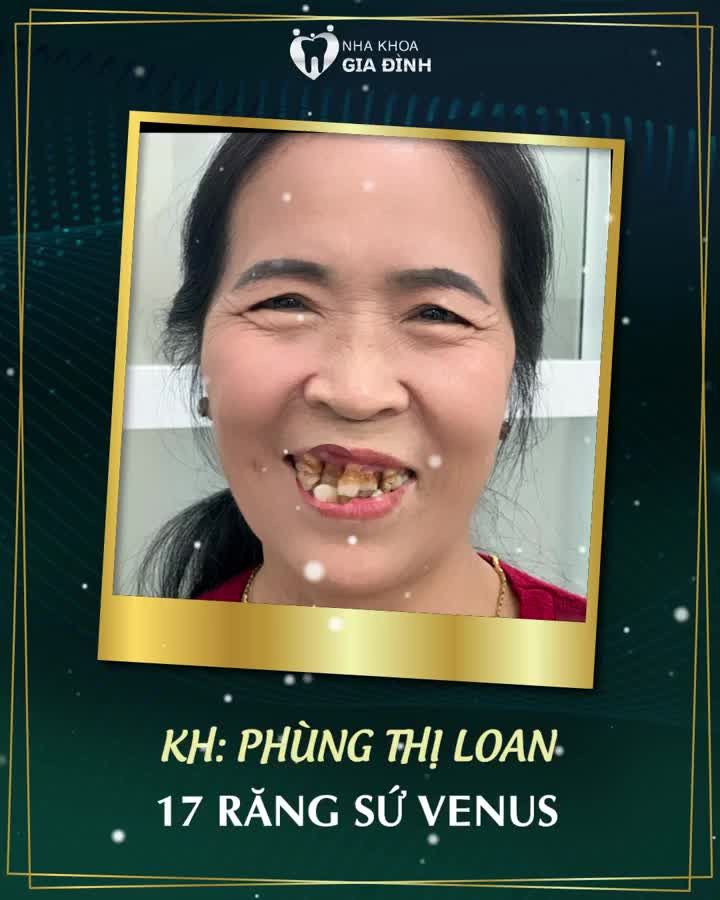 ĐÔNG VỀ THAY NỤ CƯỜI MỚI ĐẠI TIỆC TRI ÂN KHÁCH HÀNG ƯU ĐÃI ĐẾN 70%