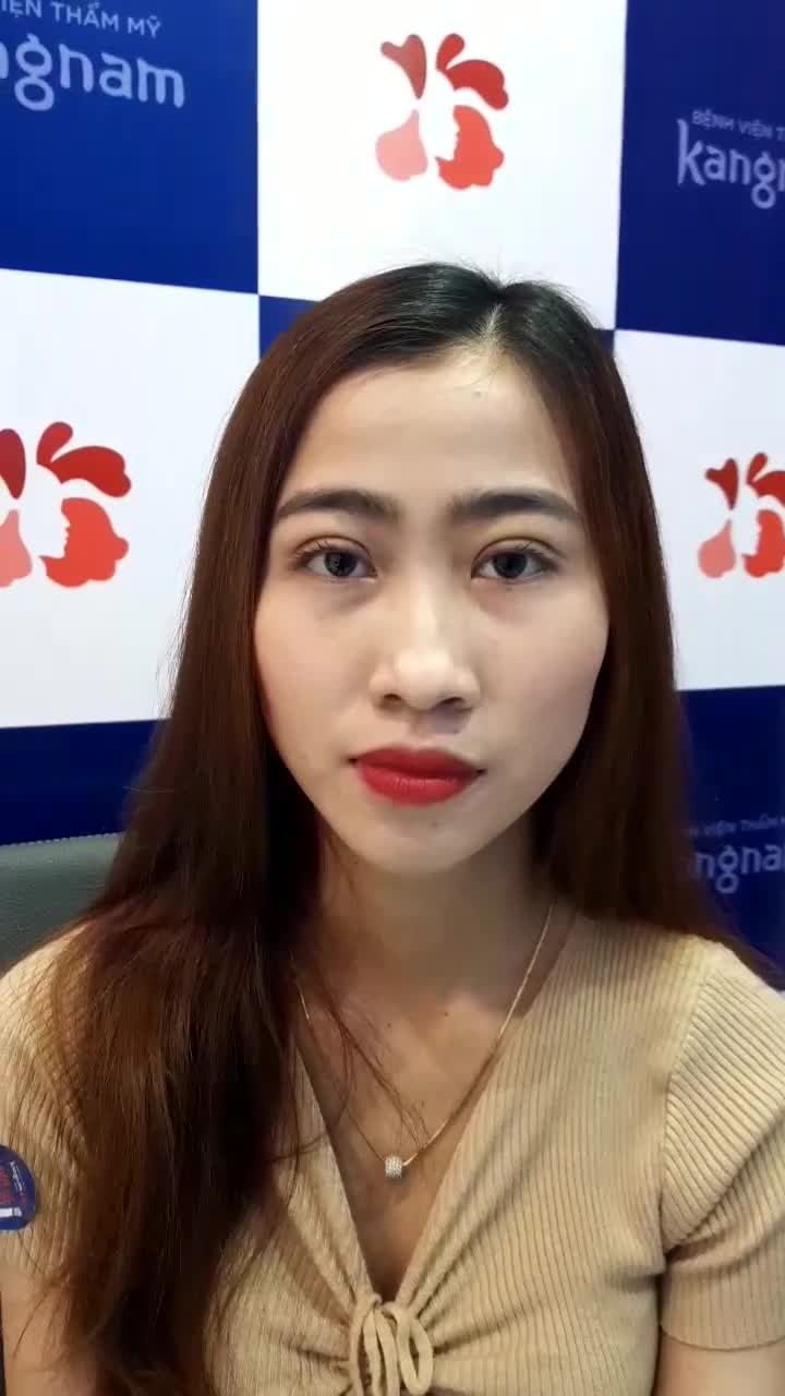 Kiểm chứng Mí đẹp sau 7 ngày Người thật việc thật đây ạ!