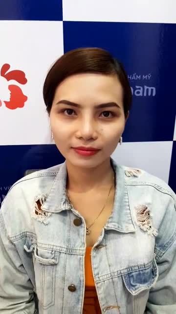 Muốn nâng mũi đẹp kịp Tết Chọn đúng công nghệ, chọn đúng bác sĩ