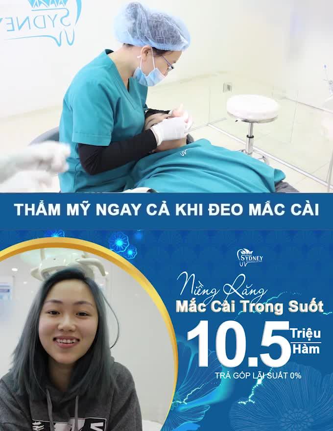 NIỀNG RĂNG MẮC CÀI TRONG SUỐT