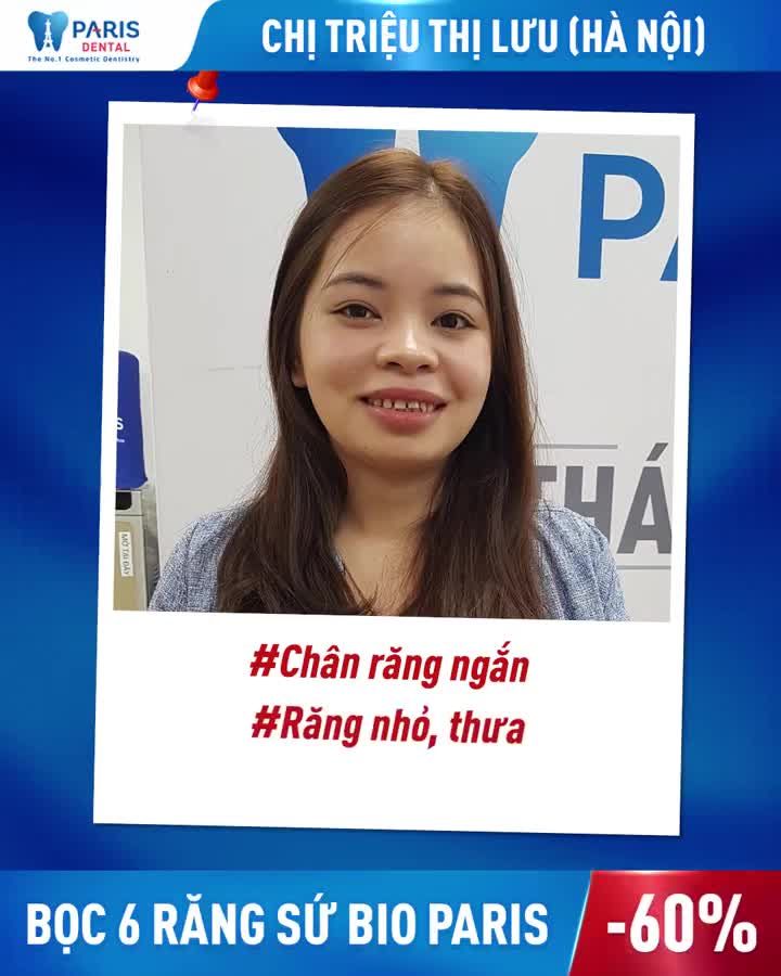 2 Ngày Bọc Răng Sứ Rước Lộc Đầu Năm