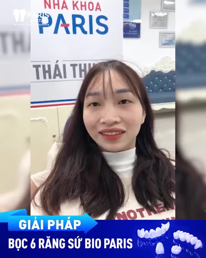 2 Ngày Bọc Răng Sứ Tự Tin Đón Tết