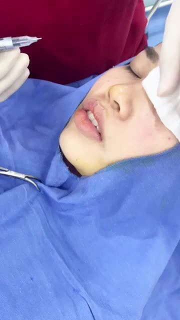 ĐO VẼ TẠO HÌNH MÔI TRÁI TIM