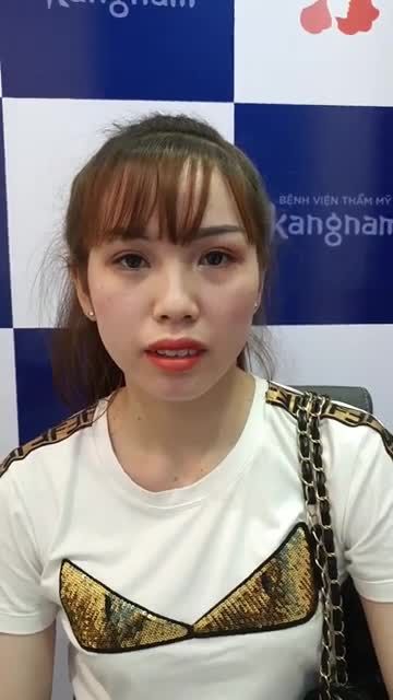 Khách hàng lột xác sau khi cắt mí trên plama
