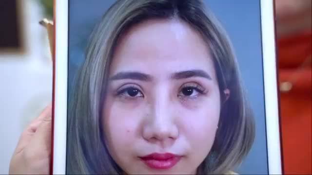 Mí xấu, hỏng, lỗi Dr.Hải Lê dều có thể GIẢI CỨU thành công nhờ kỹ thuật Sửa mí Deep Tech20. BẤM XEM NGAY!