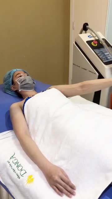 Quá trình triệt lông tay