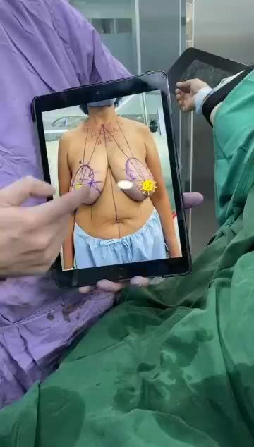 GIẢI CỨU THÀNH CÔNG CA NGUC PHÌ ĐẠI SA TRỄ ĐỘ 4 CHO KH 60 TUỔI