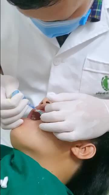 CUỐI NGÀY LẮP VENEER SỨ CAO CẤP CHO NAM KHÁCH HÀNG