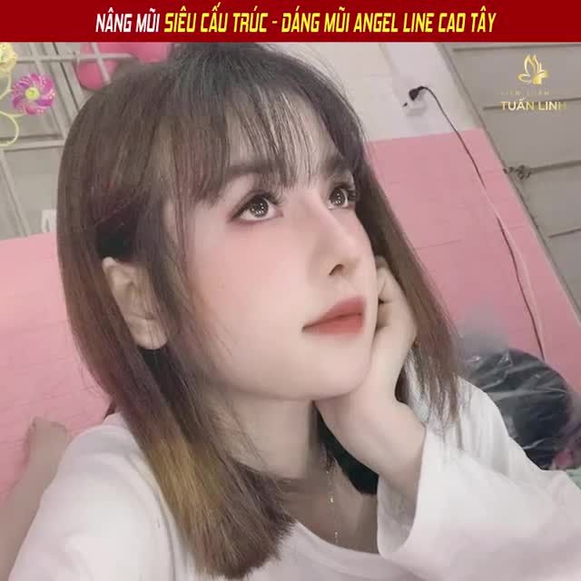 NÂNG MŨI SIÊU CẤU TRÚC DÁNG MŨI ANGEL LINE CAO TÂY