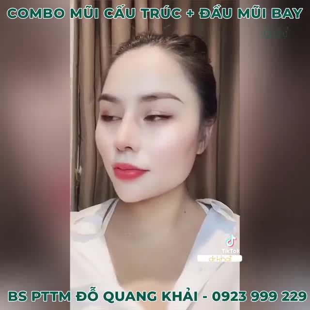 KỸ THUẬT NÂNG MŨI TẠO DÁNG ĐẦU MŨI BAY TẠI BÁC SĨ ĐỖ QUANG KHẢI