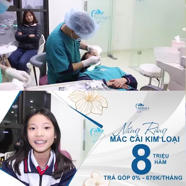 NIỀNG RĂNG MẮC CÀI KIM LOẠI CHO CON TRẢ GÓP 0 LÃI SUẤT