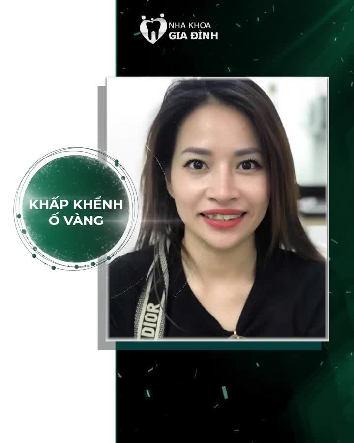 THẨM MỸ RĂNG TẠI NHA KHOA GIA ĐÌNH BẢO TỒN TỐI ĐA RĂNG THẬT