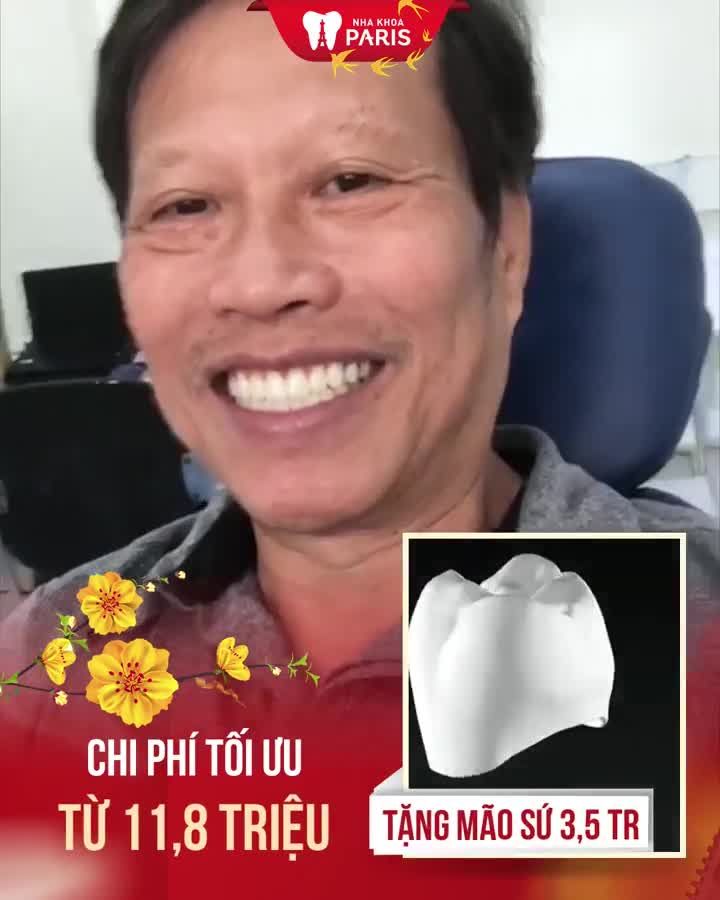 Ăn ngon đón Tết Cấy ghép implant từ 11,8TR