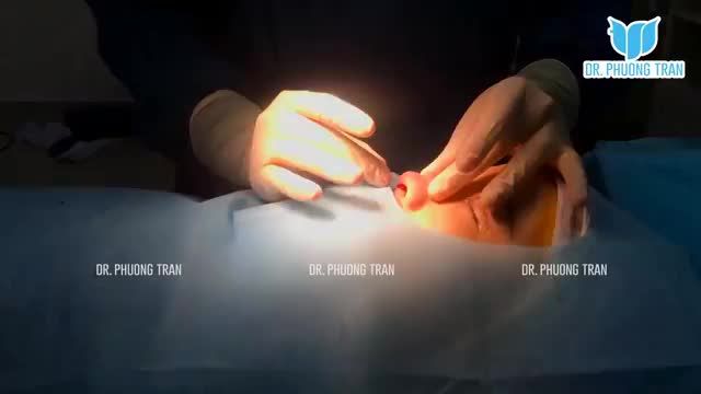 LẠI CÓ THÊM 1 "SIÊU PHẨM" ĐẾN TỪ VẬT LIỆU "VÀNG"