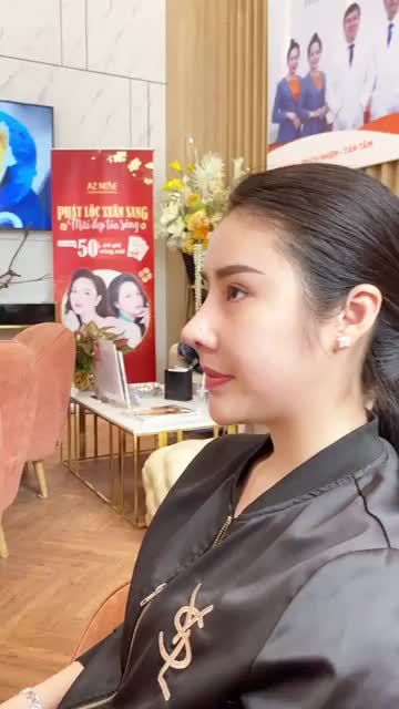 Mũi cấu trúc cần bao lâu để hoàn thiện?