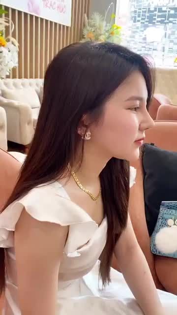 Dáng mũi Surgiform thon gọn chỉ sau 10 ngày