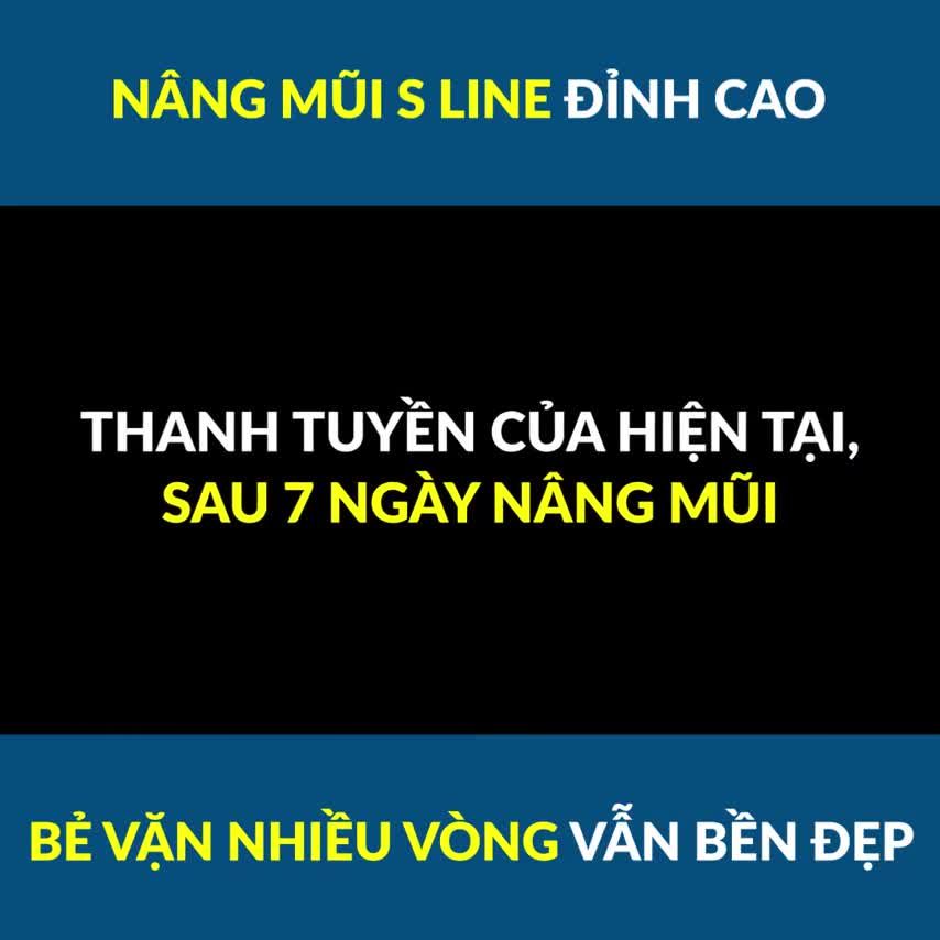 MŨI XINH ĐÓN TẾT VẶN LẮC THOẢI MÁI CHỈ SAU 7 NGÀY