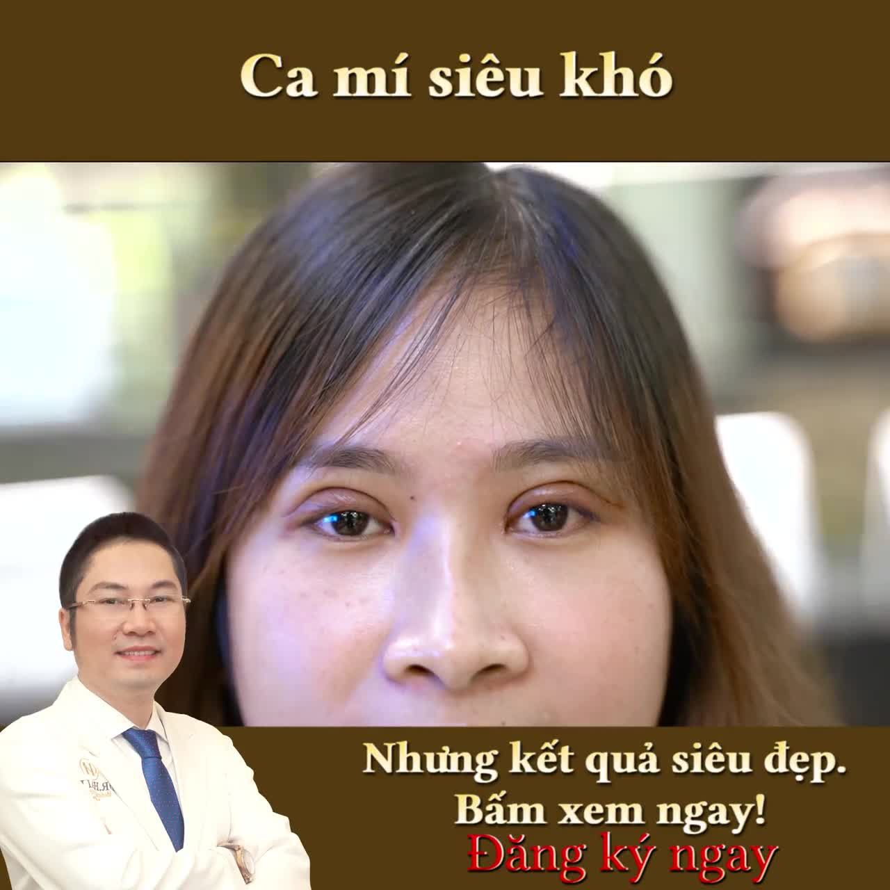 KHÁCH HÀNG TRỰC TIẾP REVIEW KẾT QUẢ THẨM MỸ KHÓ "ĐỈNH CỦA CHÓP"
