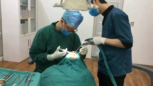 Trồng 2 implant số 36 46 cho bác khách hàng