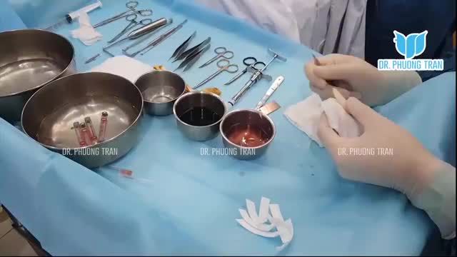 CẬP NHẬT QUÁ TRÌNH VÀ KẾT QUẢ CỦA CA MŨI SỤN SƯỜN TOÀN PHẦN Ở POST LIỀN TRƯỚC