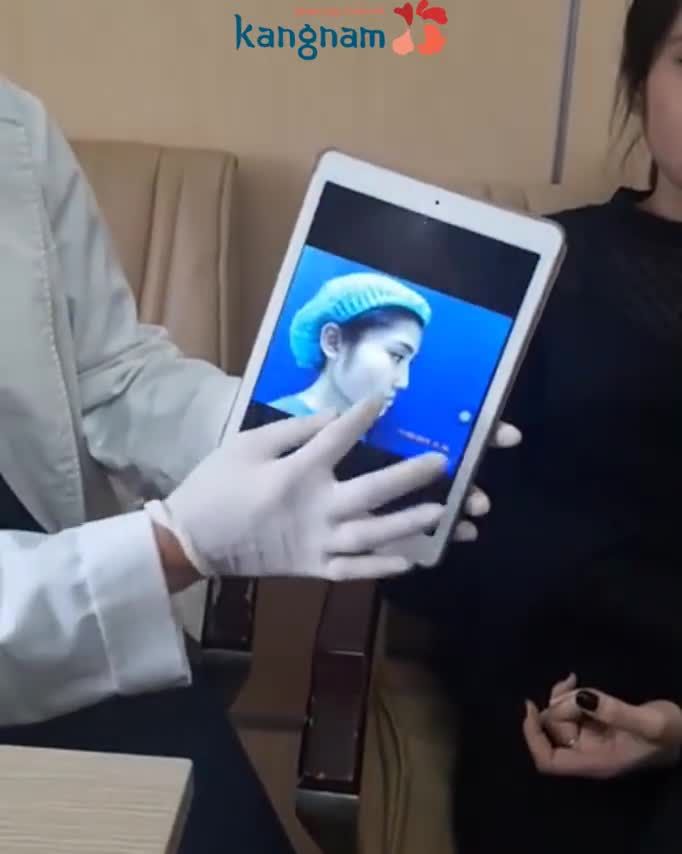 Thay đổi 180 độ sau Chỉnh Hàm Móm với 3D Face Design Đỉnh cao thiết kế khuôn mặt