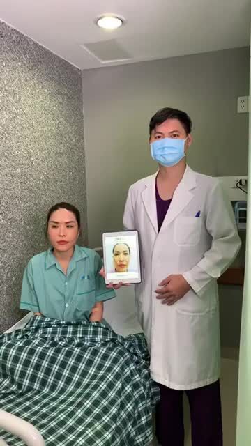 Kết quả CẤY MỠ MẶT, U40 trẻ hoá 20 TUỔI tức thì