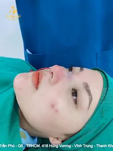 CA THỨ 3 TRONG NGÀY