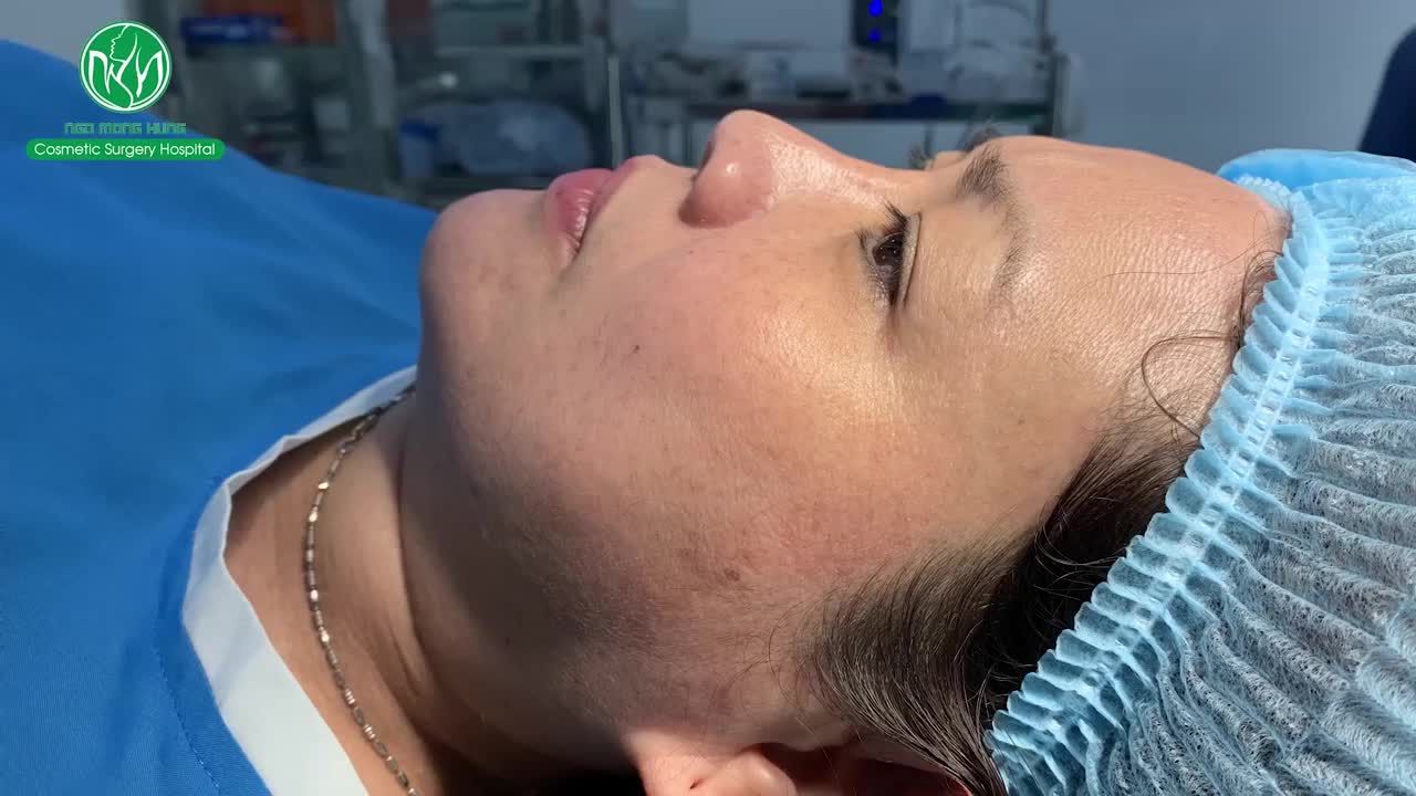 CẬN CẢNH QUÁ TRÌNH NÂNG MŨI CHO KHÁCH HÀNG