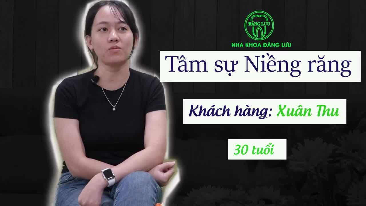 Niềng răng ở tuổi 30 có gì đặc biệt?