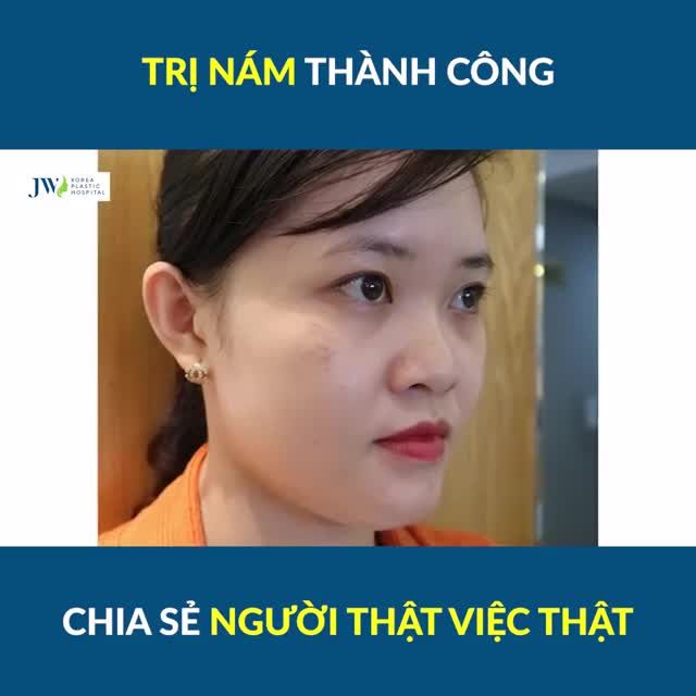 REVIEW SIÊU XỊN TỪ KHÁCH HÀNG TRỊ NÁM