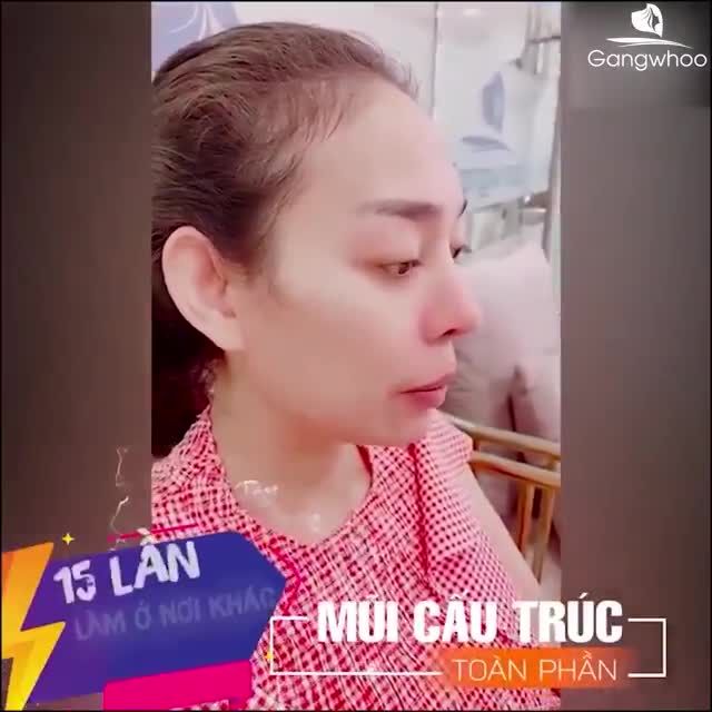SỬA MŨI HỎNG CÙNG "BÀN TAY VÀNG"
