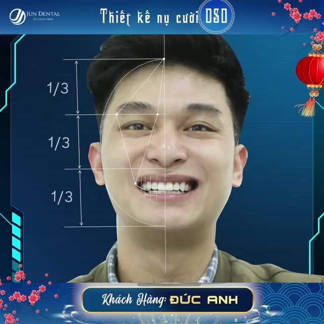 Thay răng đổi vận Răng mới đón lộc về nhà!!