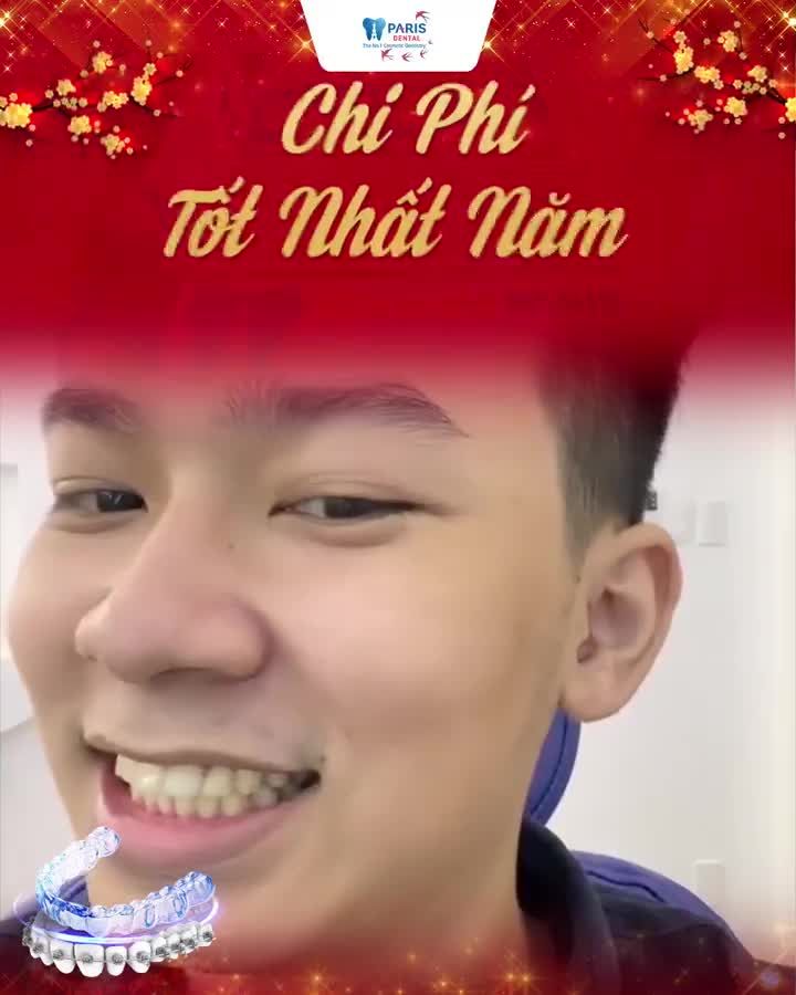Đón xuân tới Niềng răng làm mới bản thân