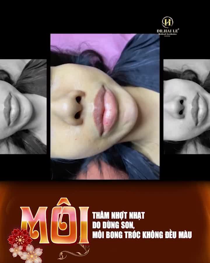 Không phải bàn cãi nữa, đây chính là “nàng thơ” trong làng phun xăm thẩm mỹ BABYLIPS nhà Dr.Hải Lê