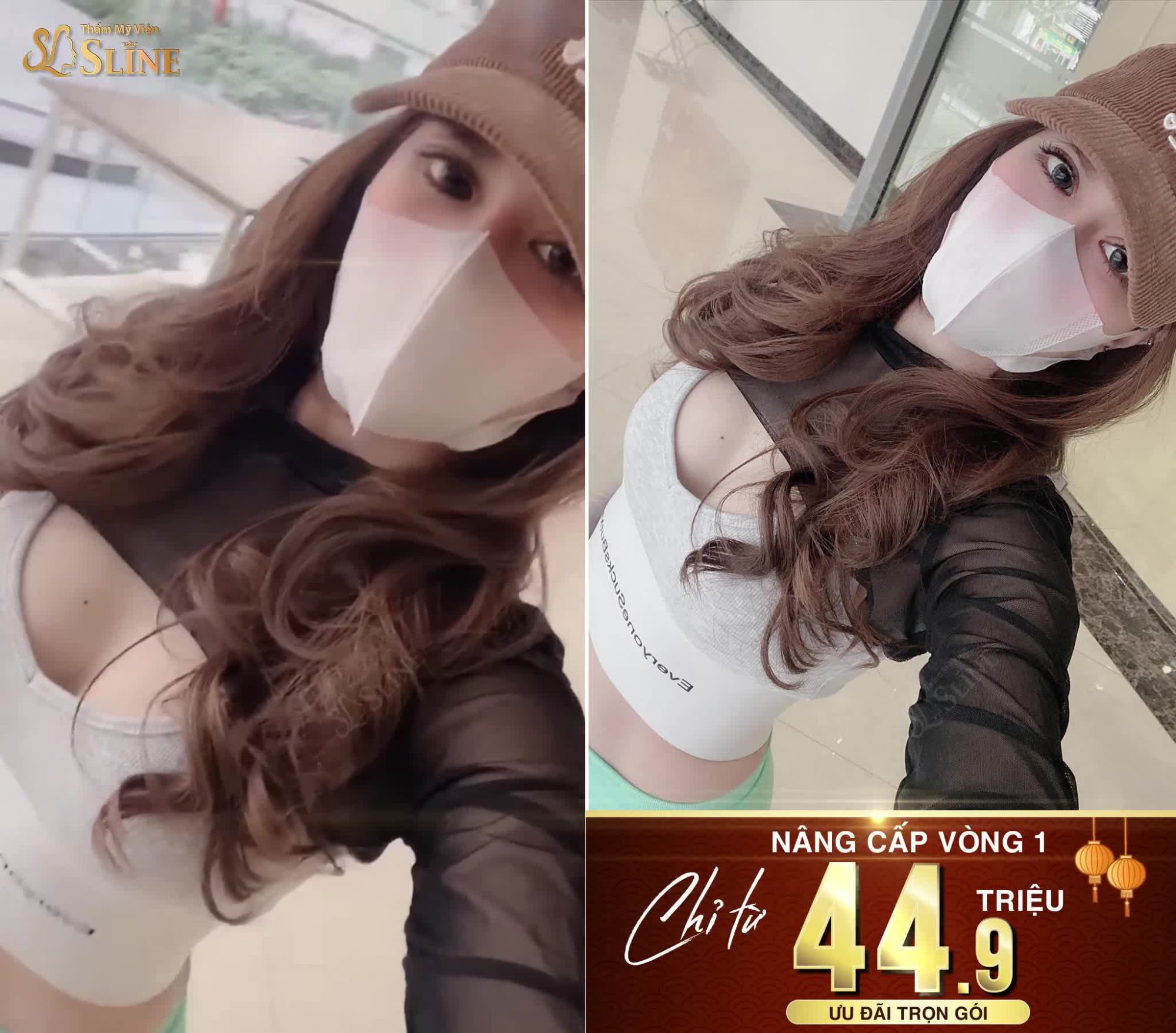 FEEDBACK "CỰC CHẤT" CỦA KHÁCH HÀNG SAU NÂNG CẤP VÒNG 1