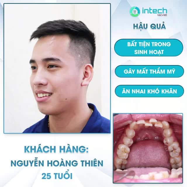 NIỀNG RĂNG KHIẾN MÌNH TỰ TIN HƠN RẤT NHIỀU