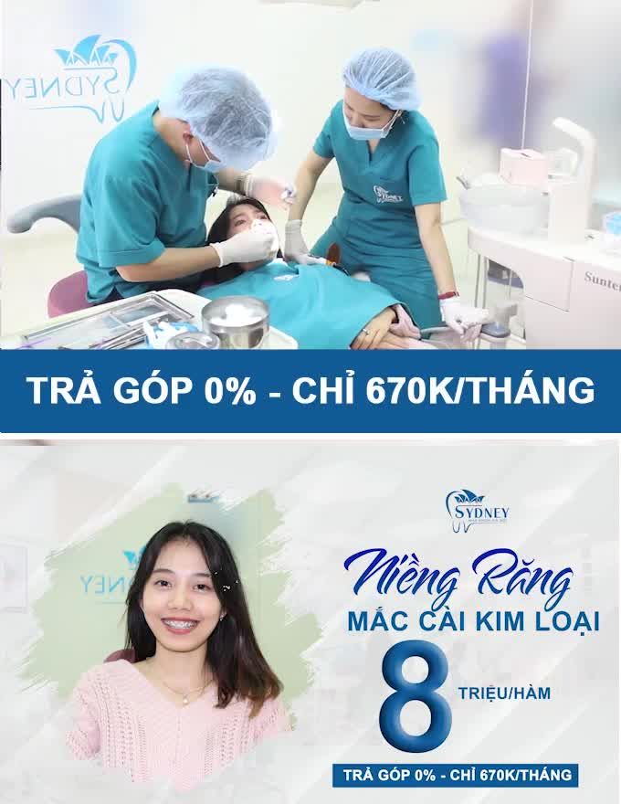 RĂNG HÔ BẠN ĐÃ BIẾT SỰ THẬT NÀY