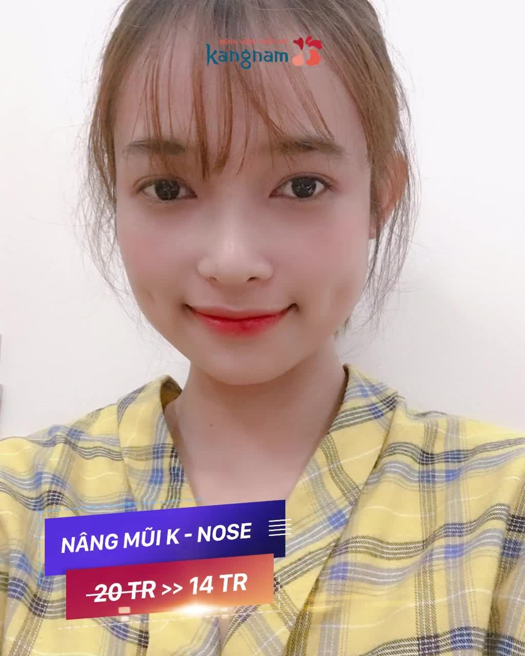 Đây rồi, Bảng giá Thẩm mỹ mũi 2021