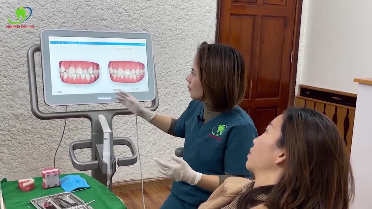 LÊN KẾ HOẠCH CHỈNH NHA CHI TIẾT CHO TRƯỜNG HỢP RĂNG LỆCH LẠC, KHẤP KHỂNH