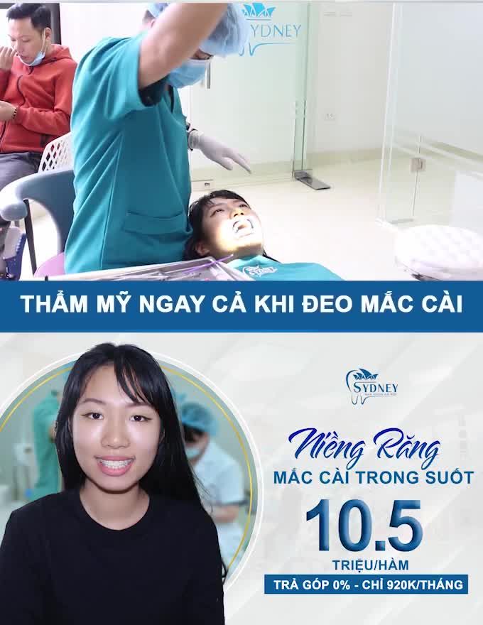 NIỀNG GÌ ĐỂ VỪA TIẾT KIỆM VỪA THẨM MĨ