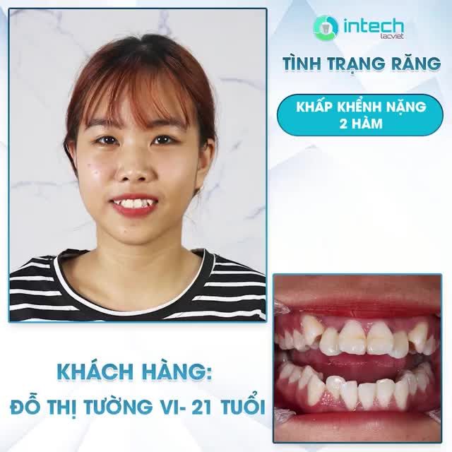 “NẾU CHẤM 10 ĐIỂM MỌI NGƯỜI SẼ NGHĨ LÀ THIÊN VỊ, VẬY EM CHẤM NHA KHOA 9/10”