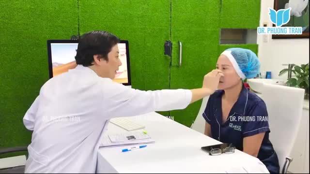 NÂNG MŨI VÀ NHỮNG NGUY CƠ CÓ THỂ GẶP PHẢI SAU PHẪU THUẬT
