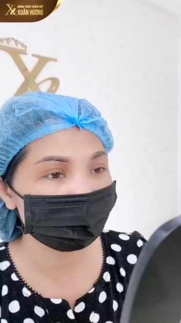 RÚT CHỈ SAU 5 NGÀY NÂNG CUNG MÀY, KHÁCH HÀNG CHIA SẺ:
