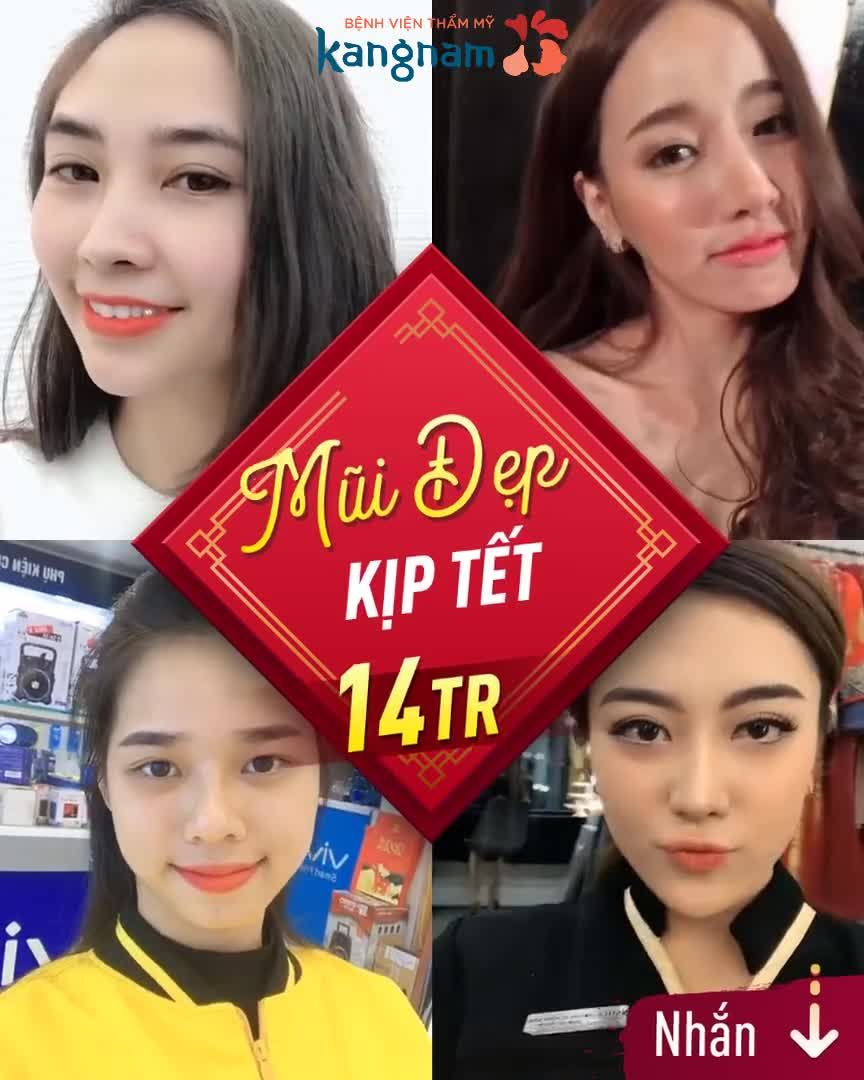 TẾT ĐẾN RỒI, NÂNG MŨI ĐI THÔI!