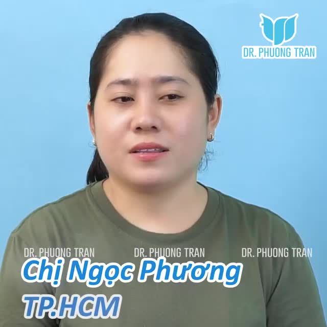 CHIA SẺ SAU 14 NGÀY NÂNG MŨI CẤU TRÚC SURGIFORM: "Ở ĐÂY MỌI THỨ ĐỀU ĐÚNG NHƯ LỜI NÓI BAN ĐẦU"