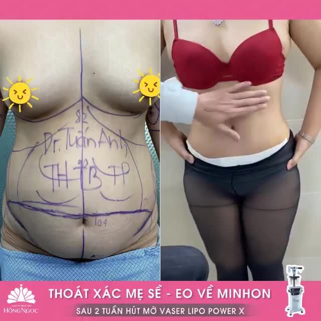 THOÁT XÁC MẸ SỀ EO VỀ MINHON SAU 2 TUẦN